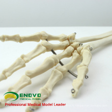JOINT11 (12358) Modèles anatomiques de squelette de bras supérieur d&#39;anatomie médicale, modèle articulé de squelette de bras